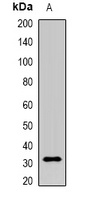 M6PR Antibody