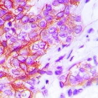 M6PR Antibody