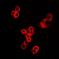 Anti-MALT1 Antibody