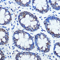 Anti-Monoamine Oxidase B Antibody