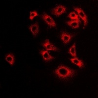 MAOB antibody