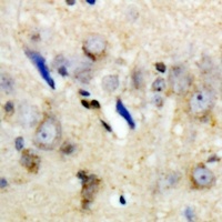 Anti-LC3A/B Antibody