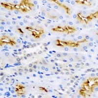 MAP1LC3B antibody