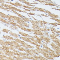 Anti-MKK5 Antibody