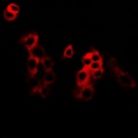 Anti-MKK5 Antibody