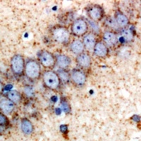 Anti-SAPK2 Antibody
