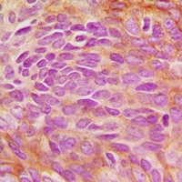 Anti-ERK5 Antibody