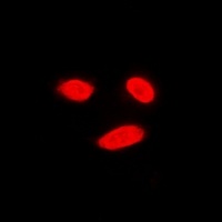 Anti-ERK5 Antibody