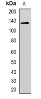 CD146 Antibody