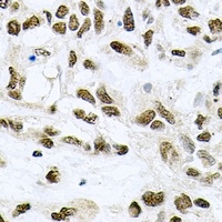 Anti-MCM6 Antibody