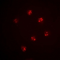 Anti-MCM6 Antibody