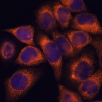 Anti-MMP25 Antibody