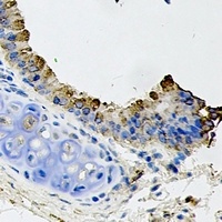 Anti-GDF8 Antibody
