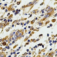 Anti-COX2 Antibody