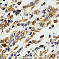 MT-CO2 antibody