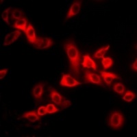 Anti-MYL2 Antibody