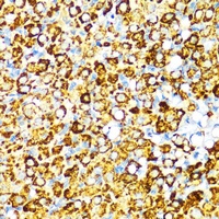 Anti-Visfatin Antibody