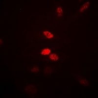 Anti-Visfatin Antibody
