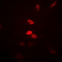 Visfatin 1 antibody