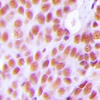 Anti-NASP Antibody