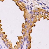 Anti-NCK2 Antibody
