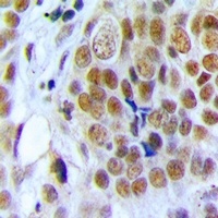 Anti-Nucleolin Antibody