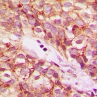 Anti-NDUFB5 Antibody