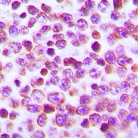 Anti-NFAT2 Antibody