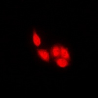 Anti-NFAT2 Antibody