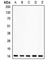 Neuroglobin Rabbit Polyclonal Antibody