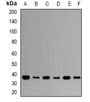 NKX2-5 Rabbit Polyclonal Antibody