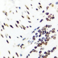 Anti-LRH-1 Antibody