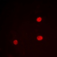 Anti-LRH-1 Antibody