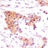 Anti-Neurotrophin 4 Antibody