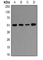 Ornithine Decarboxylase Rabbit Polyclonal Antibody
