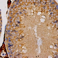 Anti-OLR1 Antibody