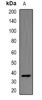 OTX2 Rabbit Polyclonal Antibody