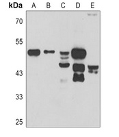 P2X2 Rabbit Polyclonal Antibody