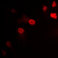 P2X4 Rabbit Polyclonal Antibody