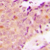Anti-hnRNP E2 Antibody