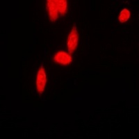 Anti-hnRNP E2 Antibody