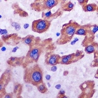 PCM1 antibody