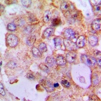 Anti-PDCD2L Antibody