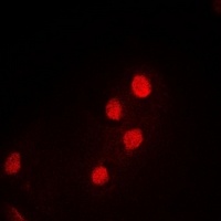 Anti-PDCD5 Antibody