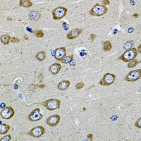 Anti-PDE1B Antibody
