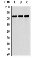 PDE4D Rabbit Polyclonal Antibody