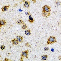 Anti-ProDynorphin Antibody