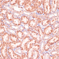 Anti-PGD Antibody