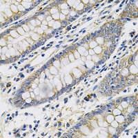 Anti-PLGF Antibody