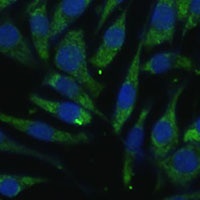 Anti-PITRM1 Antibody
